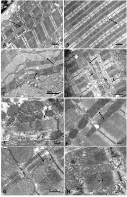 Energetic Interactions Between Subcellular Organelles in Striated Muscles